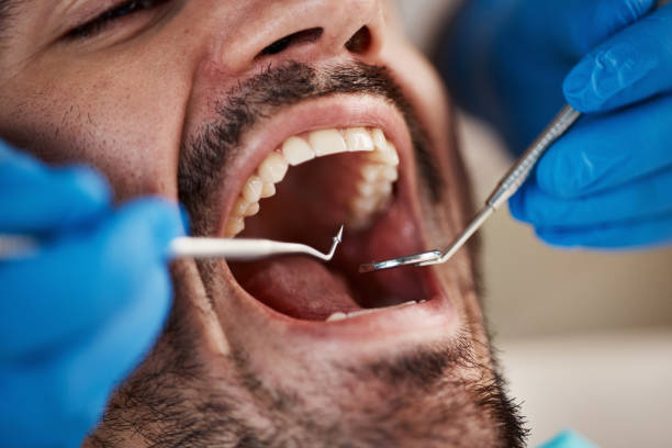 Best Emergency Broken Tooth Repair in Pike Creek Valley, DE